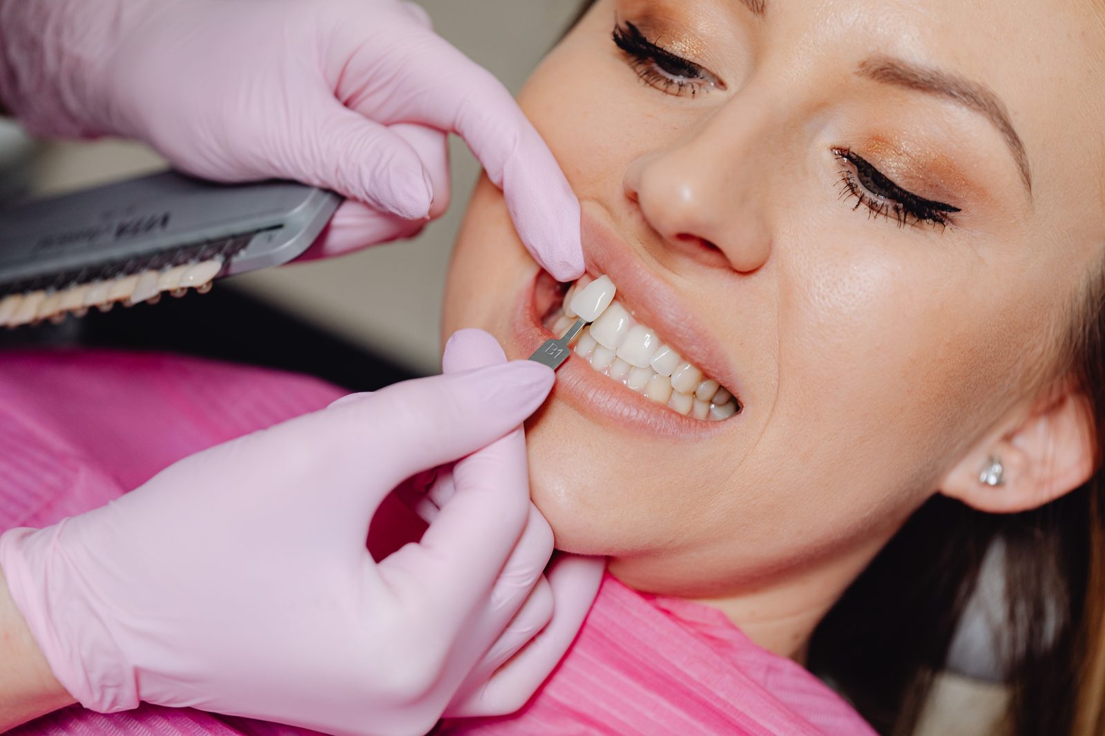 Clareamento dental: como funciona e principais cuidados