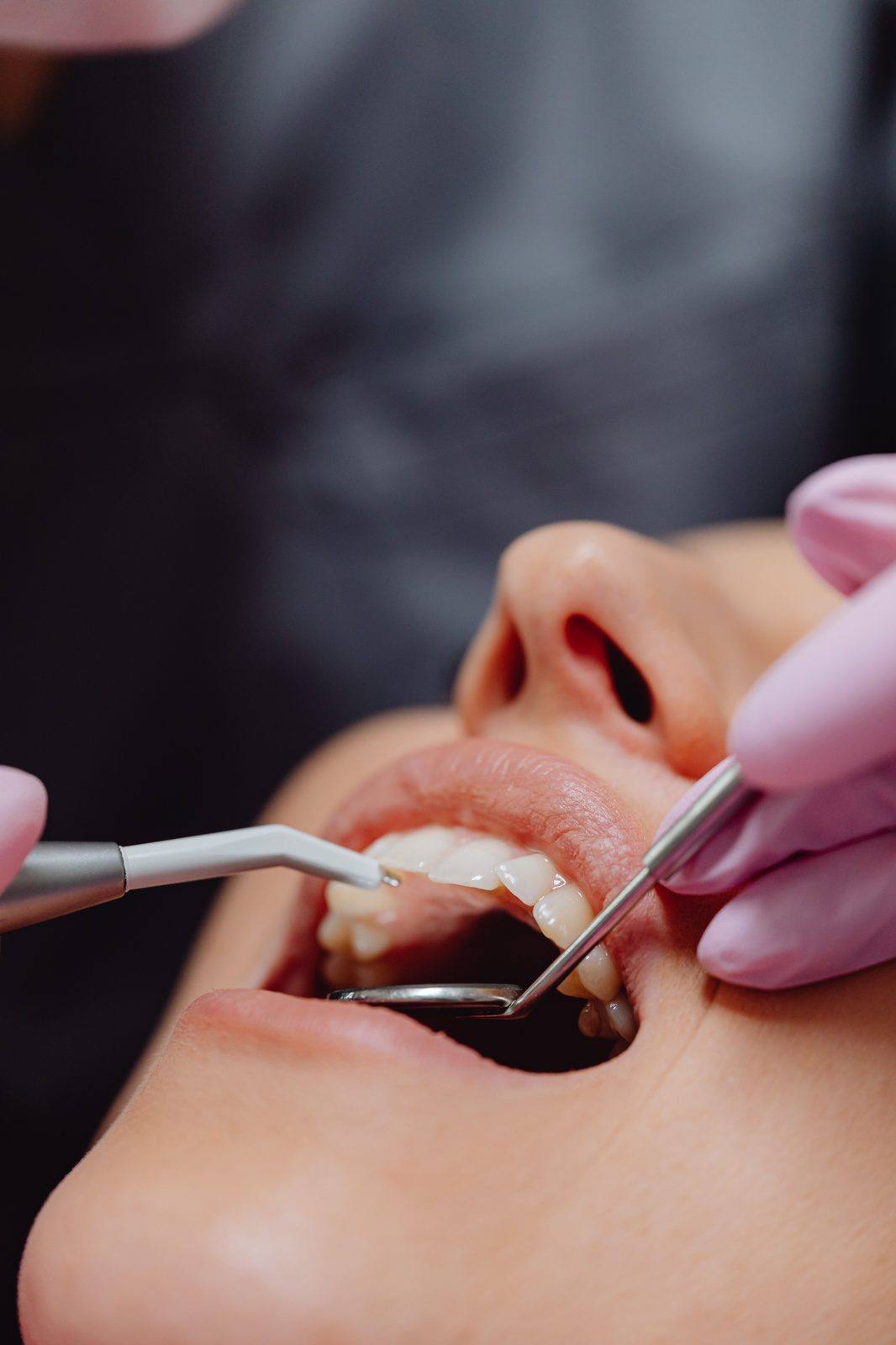 Dentista examinando os dentes do paciente com espelho clínico e sonda
