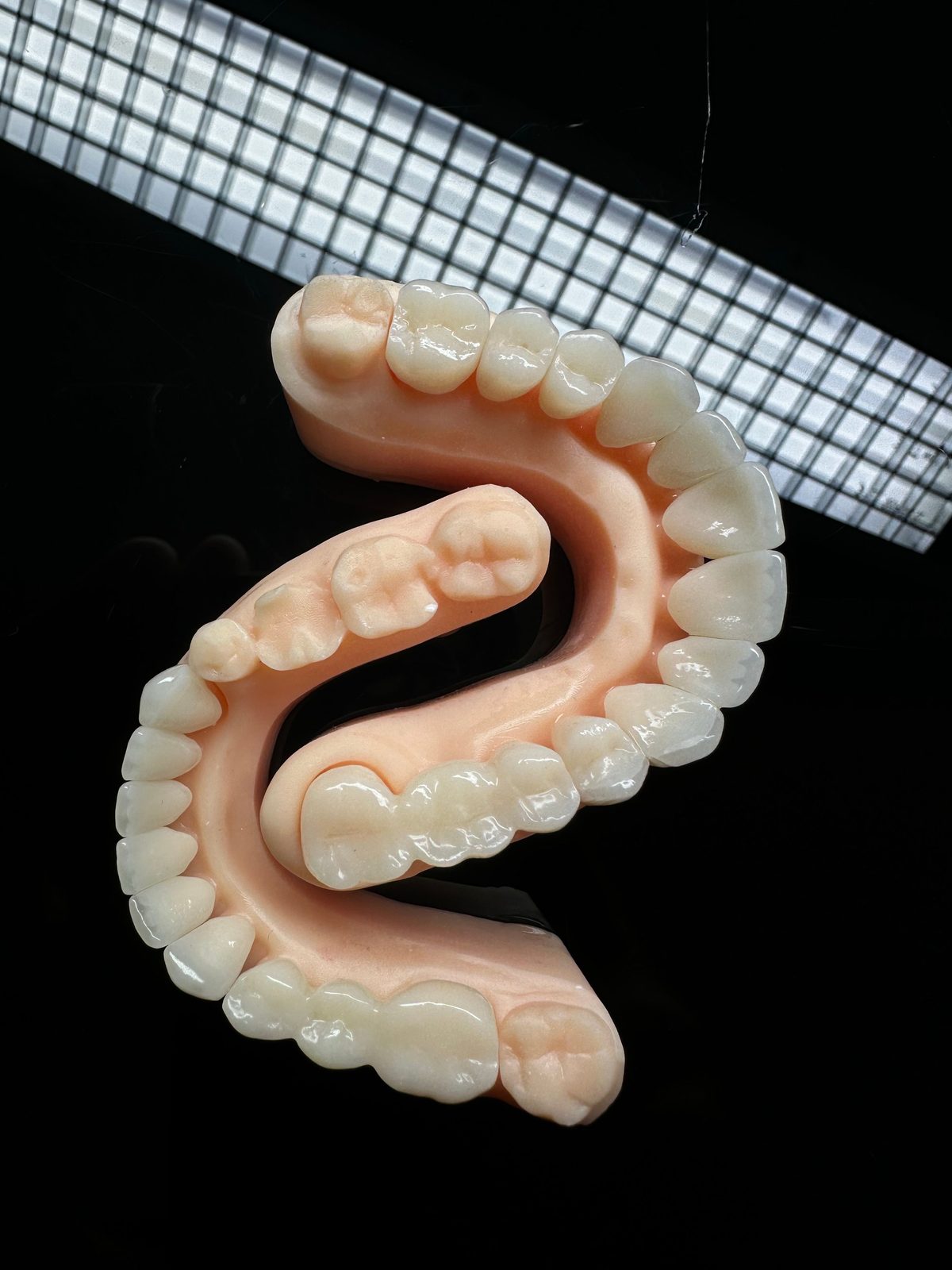 Modelo de arcada dentária usado no planejamento de trabalhos estéticos