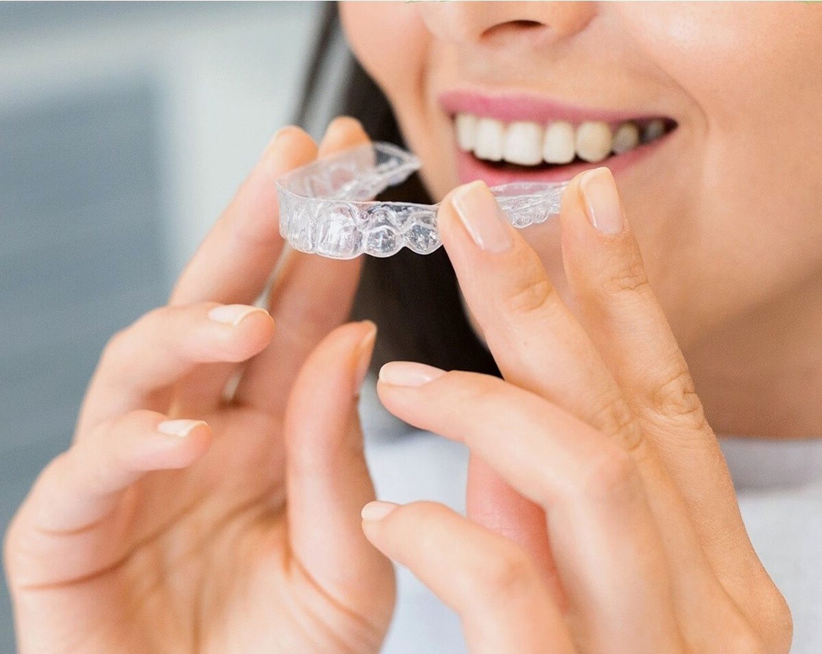 Alinhador transparente sendo posicionado sobre os dentes